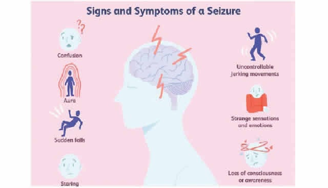 Epilepsy Seizure