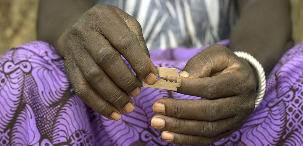 Fgm