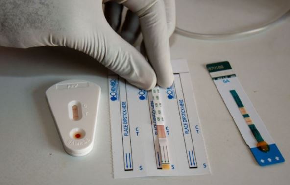 Hiv Testing Kit