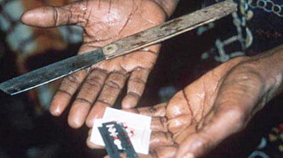 Fgm