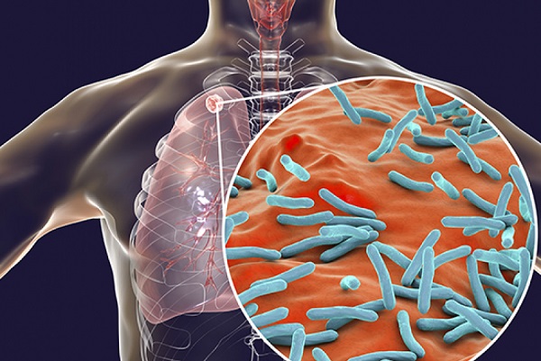 How The Pathogen Mycobacterium Tuberculosis Secretes And Trafficks Its Only Known