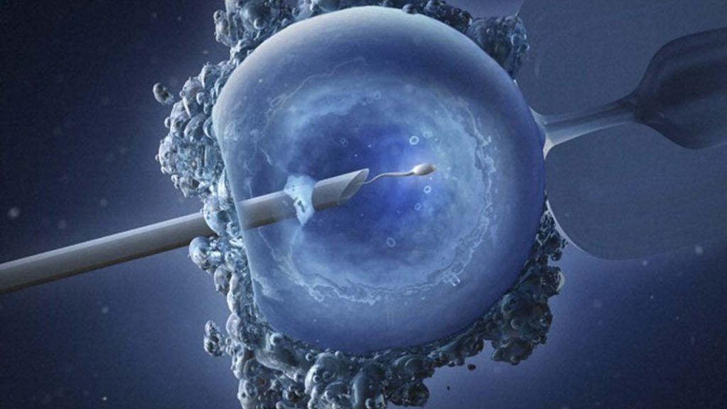In Vitro Fertilisation