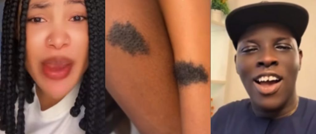 Lady Birthmark