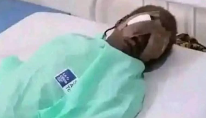 17 Year Old Boy In Bauchi Arrested For Plucking Out His 7 Year Old Sisters Eyes For A Money Ritual Six Suspects Detained
