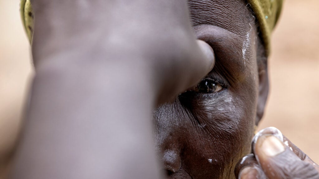 1907 Sightsavers Woman In Nikki Region Benin Has Eyes Checked Crop 1024X575 1