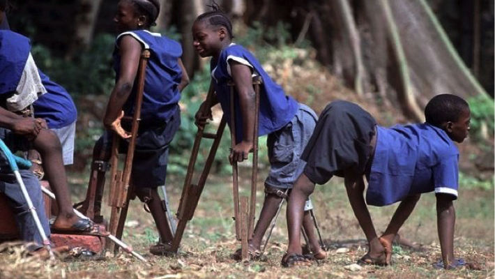 Child Suffering From Polio