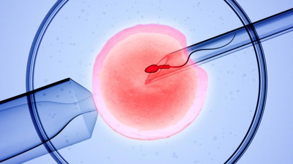 Ivf