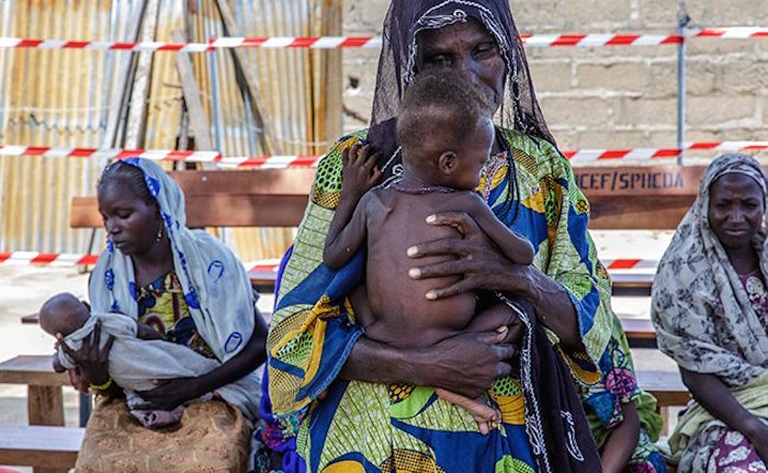Malnutrition In Nigerias North East Malnutrition In Nigerias North East