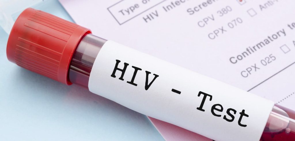 Hiv Test