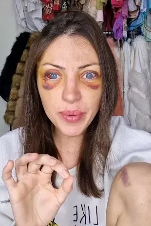 0 Police Are Investigating The Mystery Death Of An Influencer Who Called Herself Inhuman Doll And Ha 1762340613