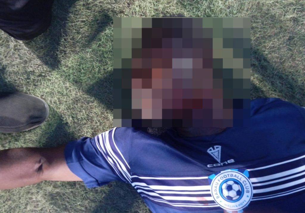 Barau Fc Player Stabbed In Neck Barau Fc Player Stabbed In Neck